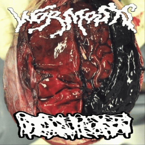 Wormosis : Wormosis - Hydrocephalus